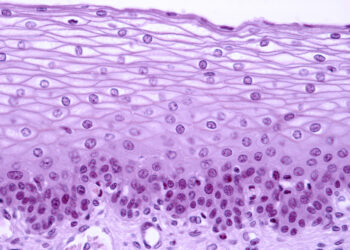 Epithelial lining of the exocervix
