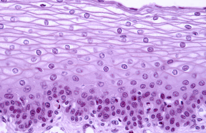 Epithelial lining of the exocervix
