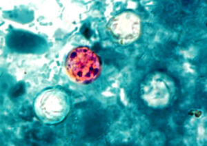photo micrograph showing Presence of four cyclospora cayetanensis oocysts